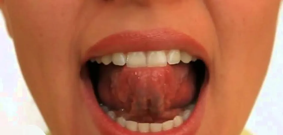 Diksiyon alıştırmaları FOTO: Diksiyon Alıştırmaları